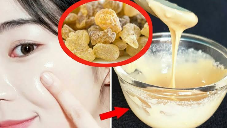 تخلصي من التجاعيد وهتبقى اصغر 10 سنين.. طريقة تحضير وصفة كولاجين لبان الدكر لشد التجاعيد تخلصي من التجاعيد وهتبقى اصغر 10 سنين.. طريقة تحضير وصفة كولاجين لبان الدكر لشد التجاعيد