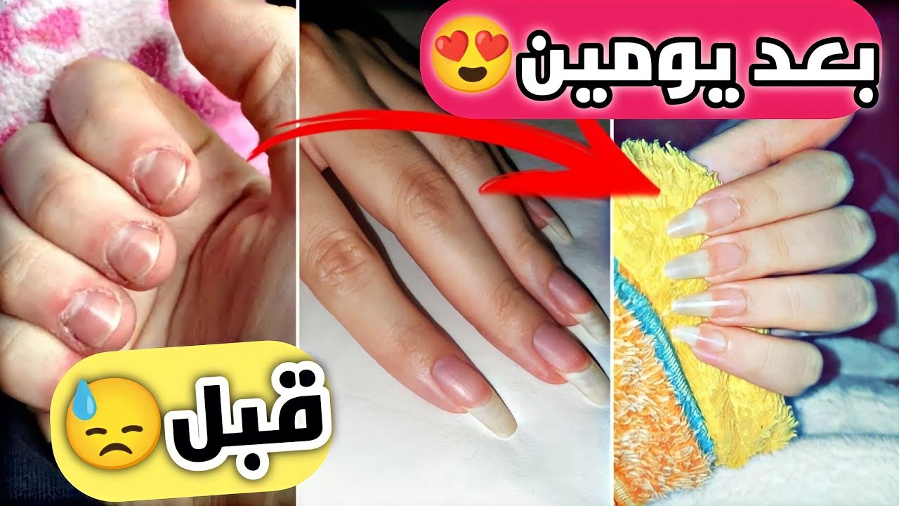 “للعرسان الجداد”.. خلطات لتطويل الأظافر طبيعية بالمنزل وبخطوات سهلة وبسيطة مش هتجتاج منك وقت!